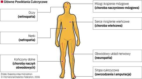 572.a. CUKRZYCA !!.JPG